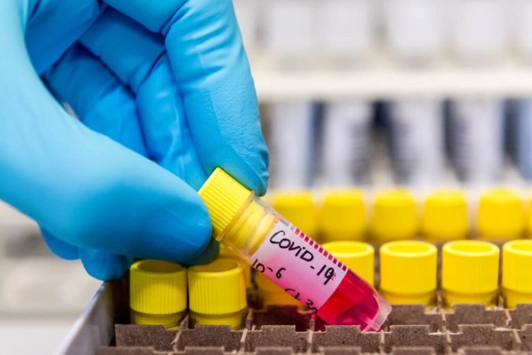 Immune System Reaction With Covid-19 Could Be Proportional To The Intensity And Timeframe Of The Disease