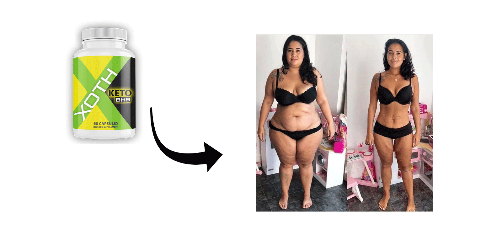 XOTH Keto Results 