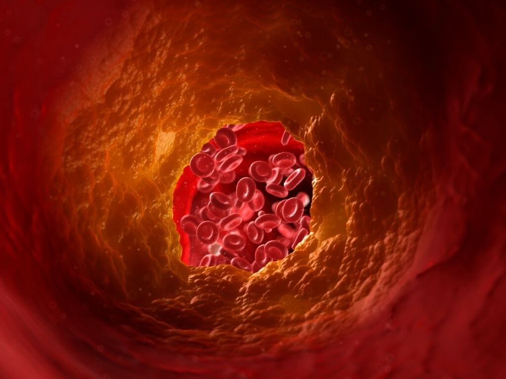 High-Cholesterol-Condition-And-What-If-Its-Left-Undertreated-1