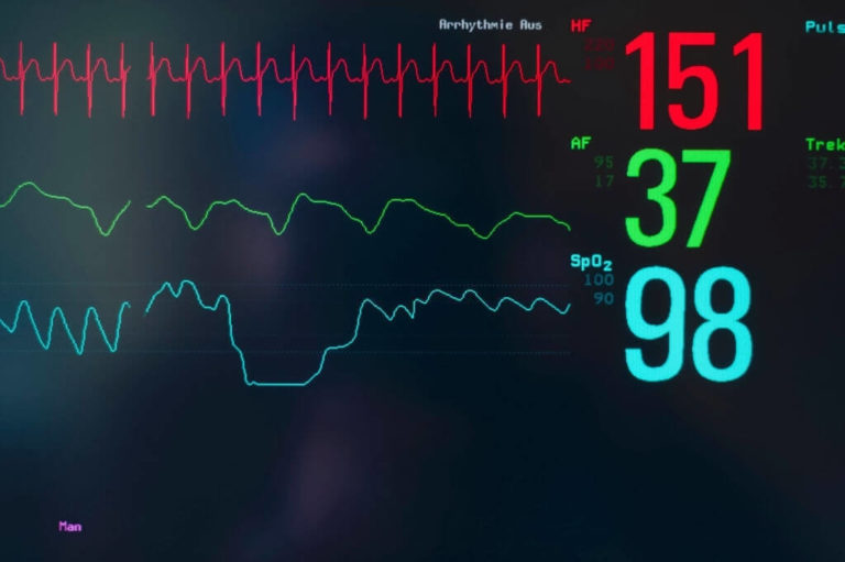 Prediction-Of-Hospitalized-Patients-Done-By-Shrinking-Waveforms-On-Electrocardiograms-1