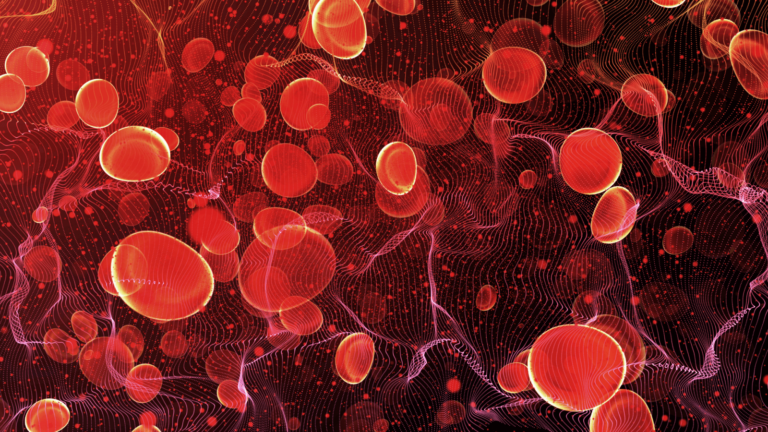 RDW (Red cell Distribution Width) SD high - meaning, causes and cure.