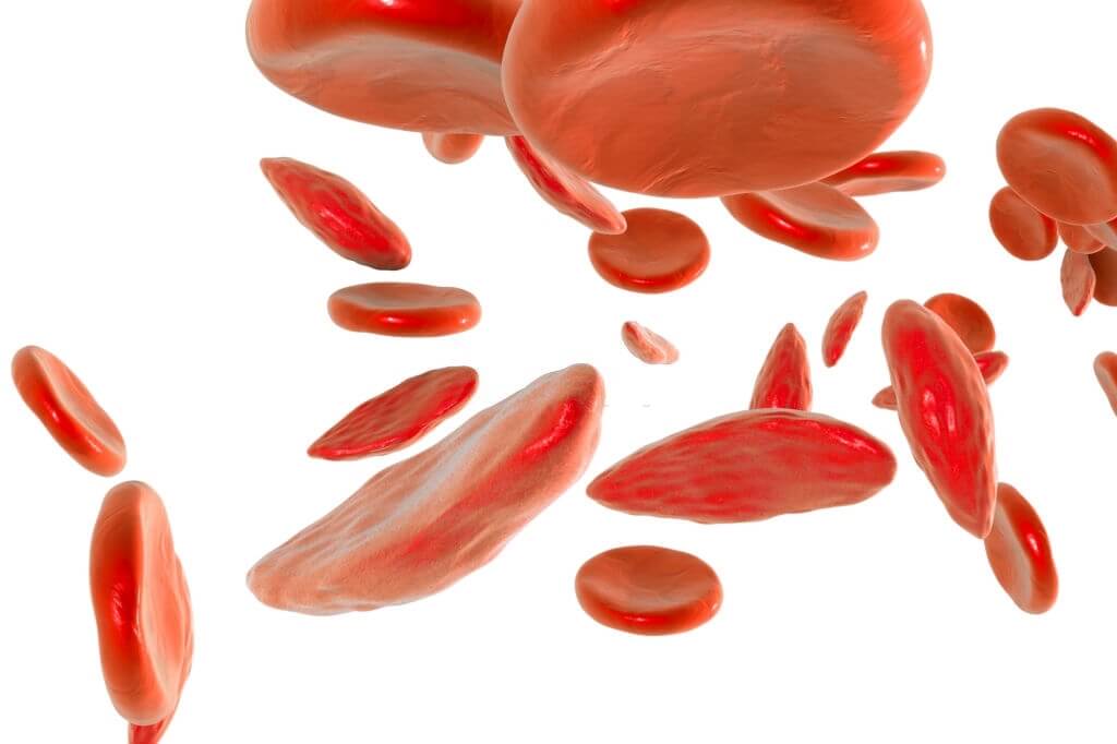 Finding-Compassionate-Treatment-Is-A-Problem-For-Sickle-Cell-Patients-1