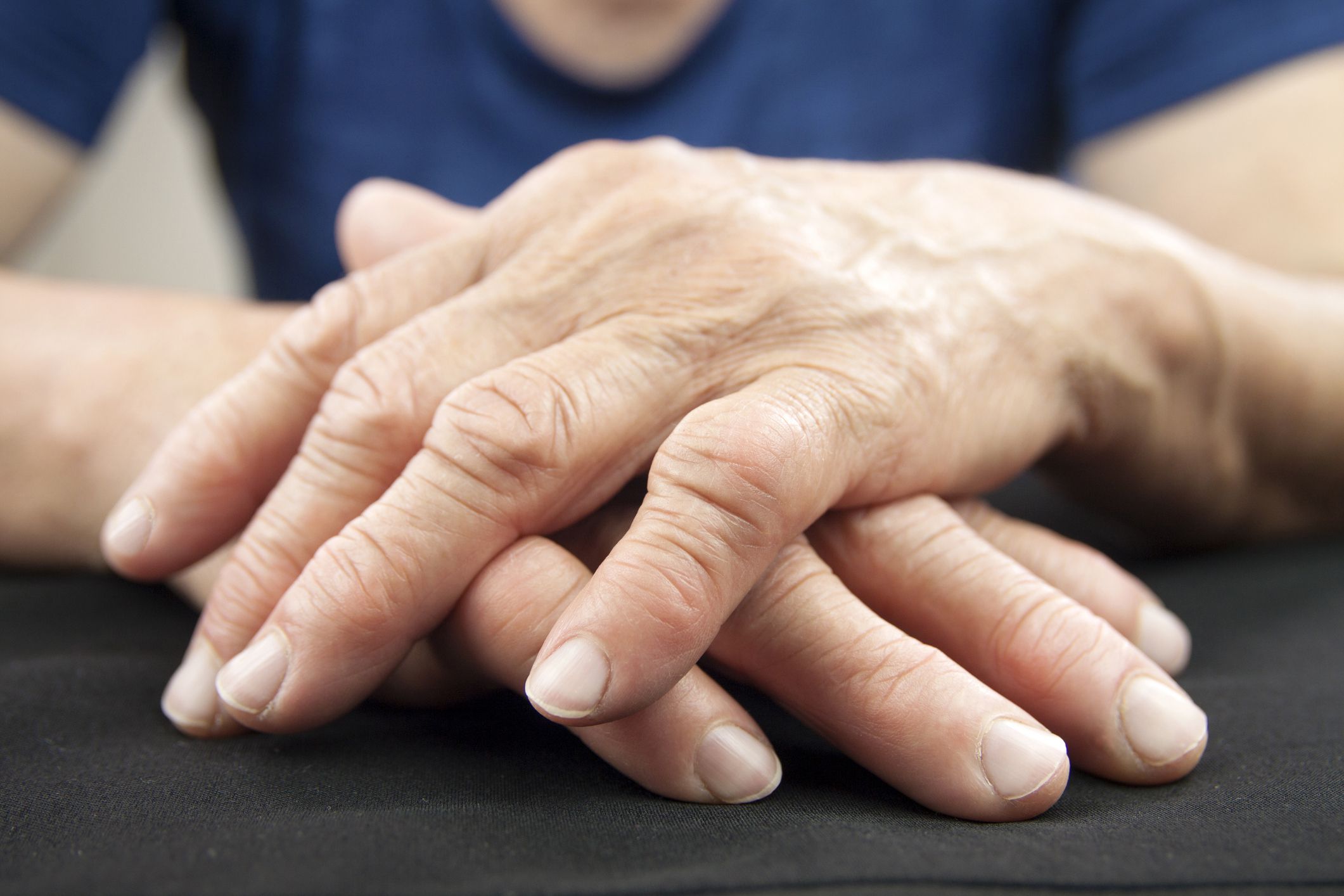 Rheumatoid Arthritis Kept In Check With A Two-Pronged Approach