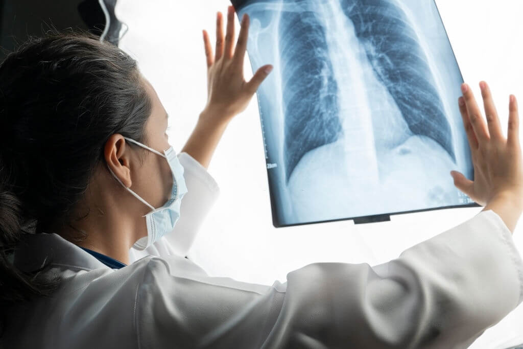 The-Effectiveness-Of-Virtual-Lung-Cancer-Screening-Is-Comparable-1