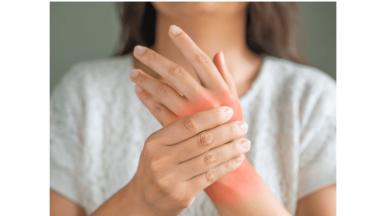 Women With RA Have Fragile Bones