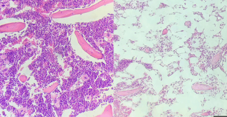 w Approach Could Make Stem Cell Transplants Safer