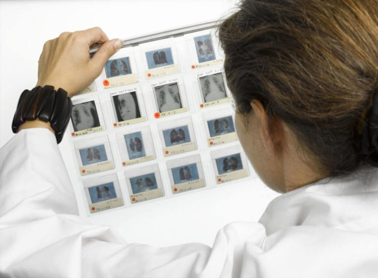 A New Strategy For Ovarian Cancer Treatment Has Been Developed