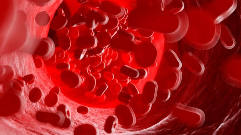 Blood-Clots-Can-Be-Detected-Noninvasively-With-Non-Invasive-Technique-1