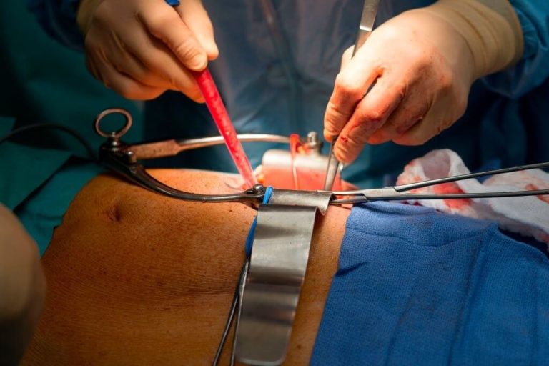 Diagnosing And Predicting The Success Of Kidney Transplants