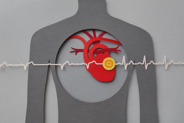 Genetic-Testing-Reveals-A-Link-Between-Heart-Failure-and-Arrhythmia-1