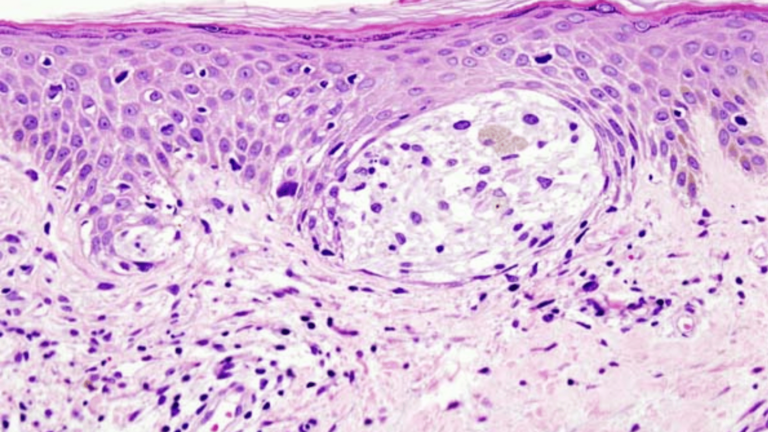 Immunotherapy-Given-Before-Targeted-Therapy-1