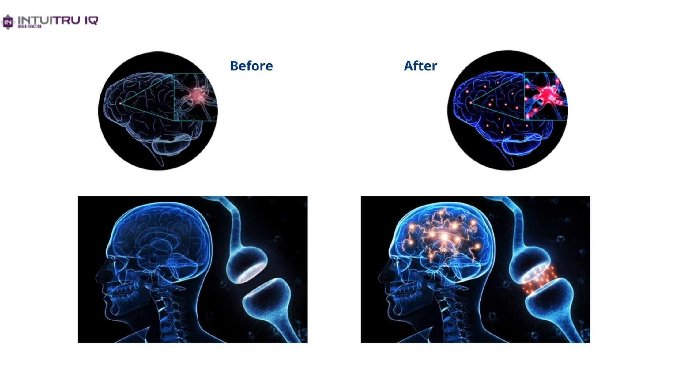 IntuiTru IQ Working