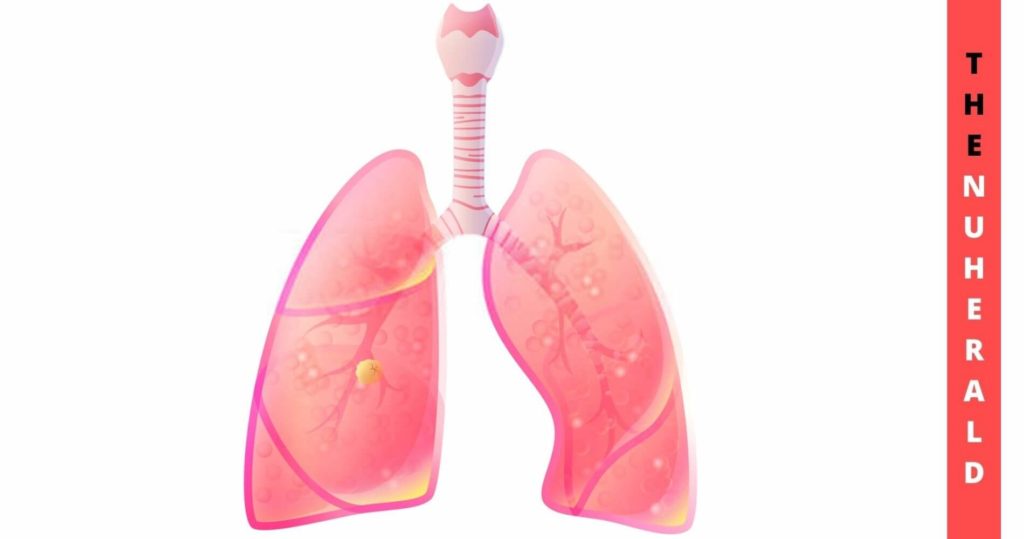 IPF And COVID-19 Damaged Lungs Show Different Stem Cell Trajectory