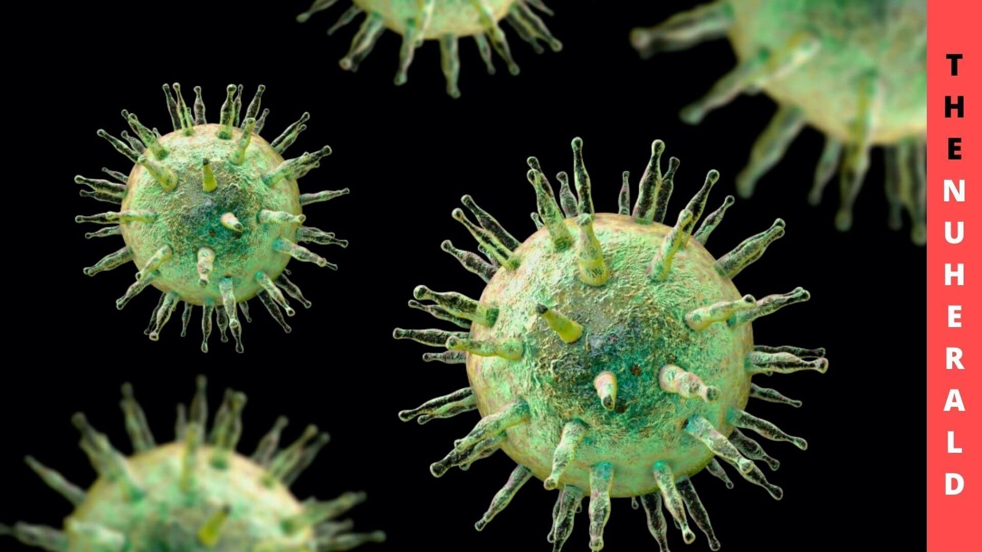Infection With Epstein-Barr Virus - The Cause Of Multiple Sclerosis
