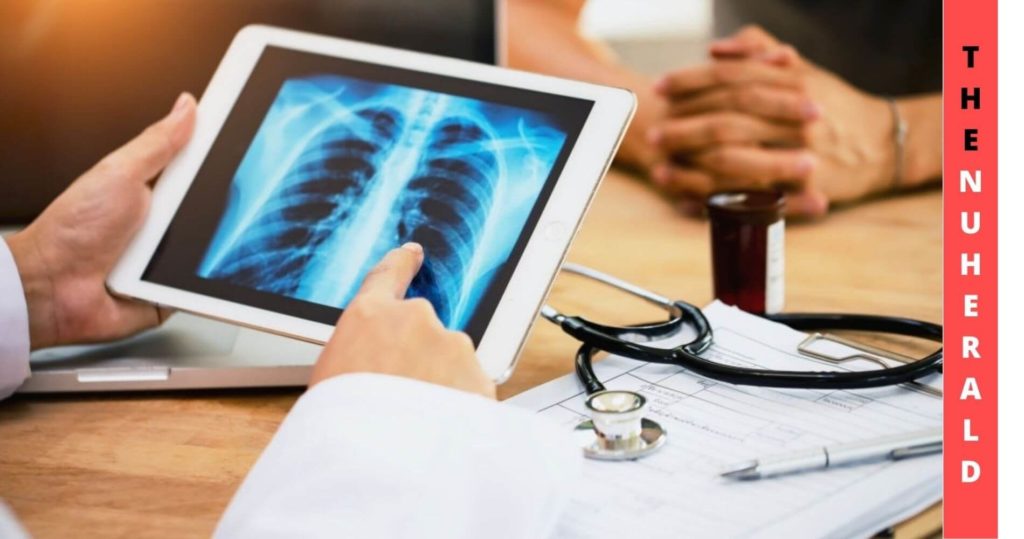 Lung Cancer Screening: Blood Test Helps Determine Who Is Suitable