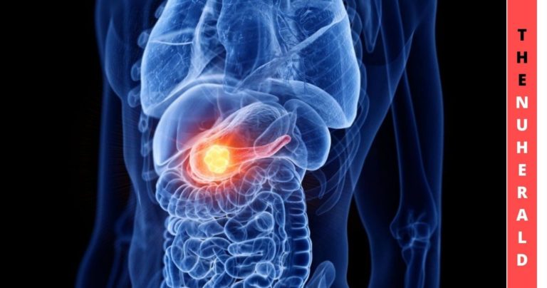 Optical-Imaging-A-New-Path-Towards-The-Pancreatic-Tumour