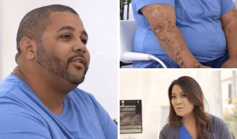 Dr Pimple Popper Season 8